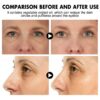 Hoygi Instant Eye Lift Cream - Firming & Hydrating Eye Care for Fine Lines, Puffiness & Dark Circles
