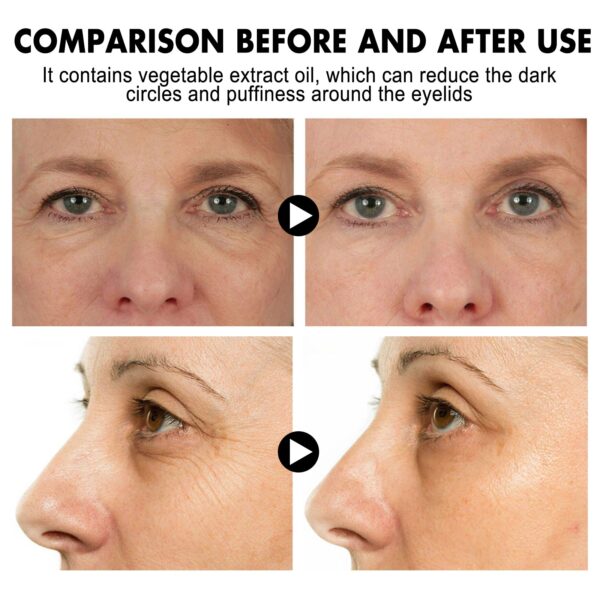 Hoygi Instant Eye Lift Cream - Firming & Hydrating Eye Care for Fine Lines, Puffiness & Dark Circles