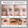 Hoygi Instant Eye Lift Serum - Roll-On Firming Eye Care for Fine Lines, Puffy Eyes & Dark Circles